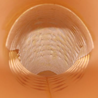 Prosthetic Pediatric Cosmetic Above Knee Using Cosmetic Cover (EVA) MESH